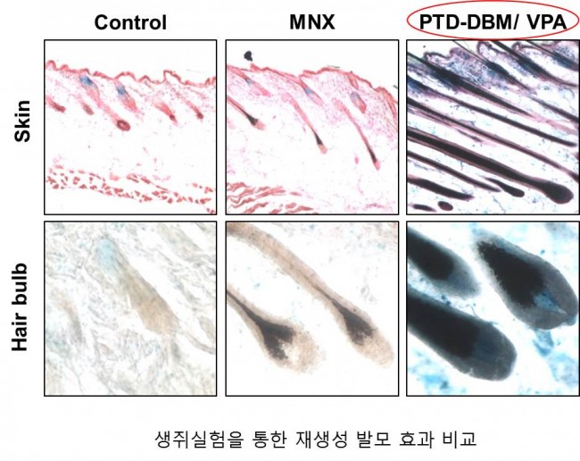 모낭의 회복. 맨 오른쪽의 새 물질 투입시 모낭의 회복이 확연하다. 탈모를 근본적으로 치료할 수 있을지 기대되는 이유다. - 최강열 제공